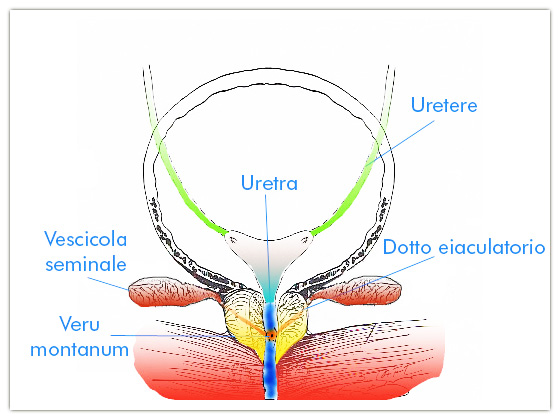 La caratteristica della prostatite cronica e prostatite acuta - Canali Prostatici