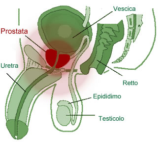 prostată acuta