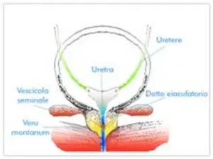 Prostatite acuta e cronica - Prostatitis2000.org