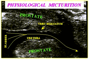 Prostatite cronica e acuta – Metodiche diagnostiche